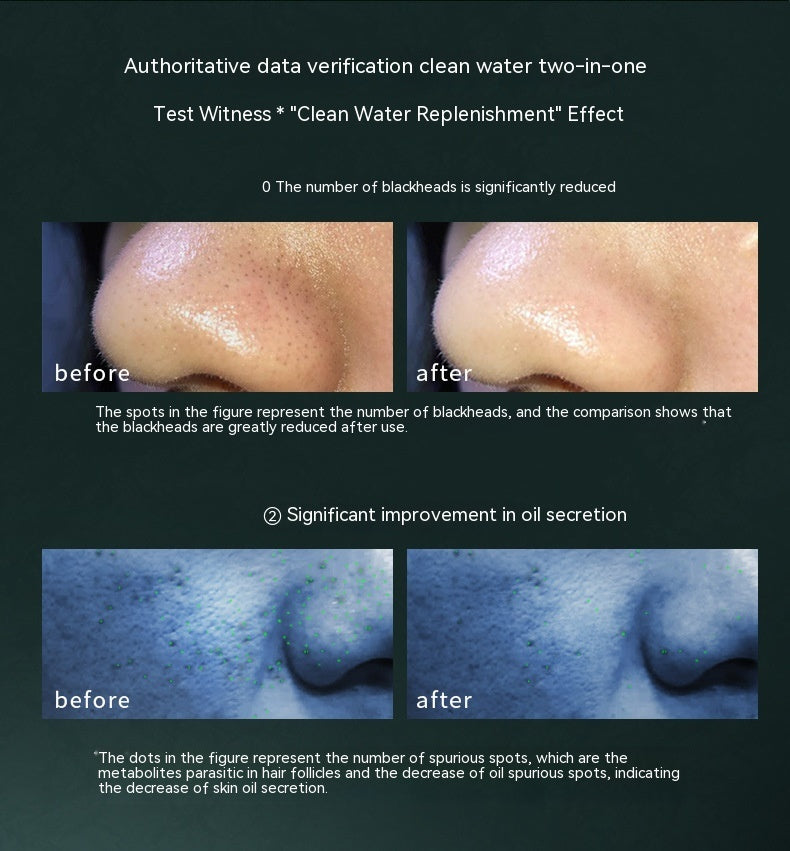 Home Electric Pore Cleaning Beauty Instrument